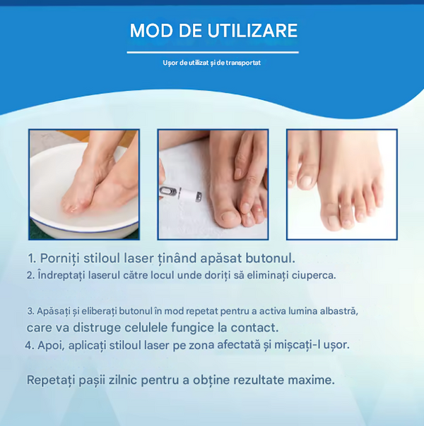 Laserul Nail Care